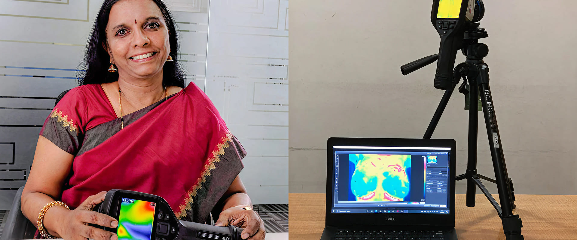 Harnessing AI and Thermal Imaging for Early Breast Cancer Detection