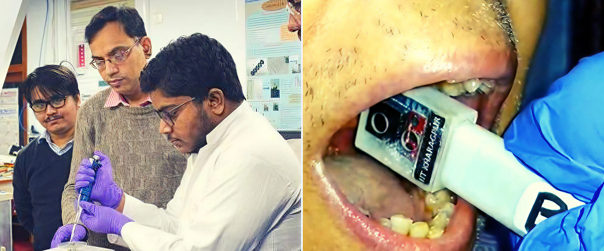 Low-Cost Oral Cancer Screening Device: A Breakthrough for India’s Healthcare Accessibility