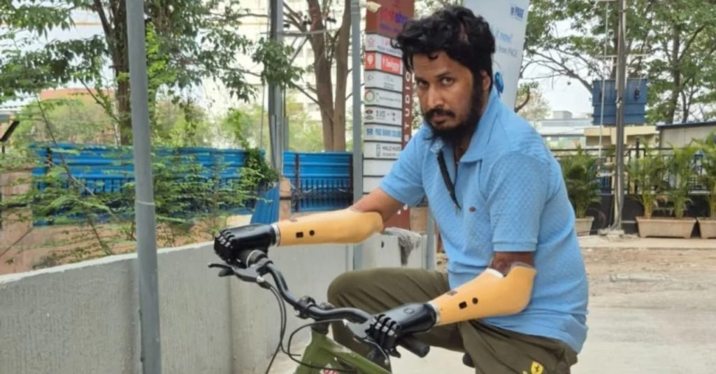 At One-Tenth the Global Cost, an Indian-Built Bionic Arm Is Reversing Disability-Linked Income Loss